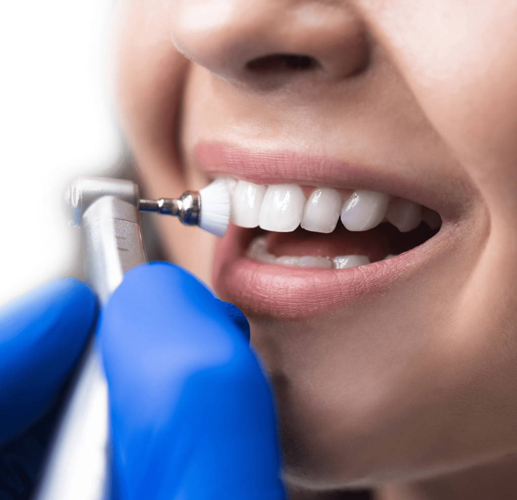 Dental treatments clinic dentist istanbul turkey