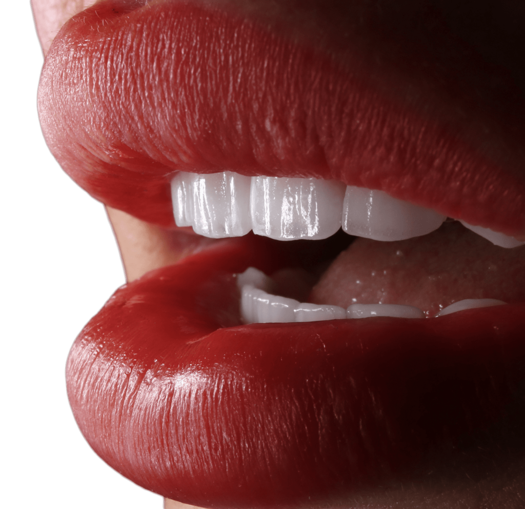 dental veneers istanbul turkey