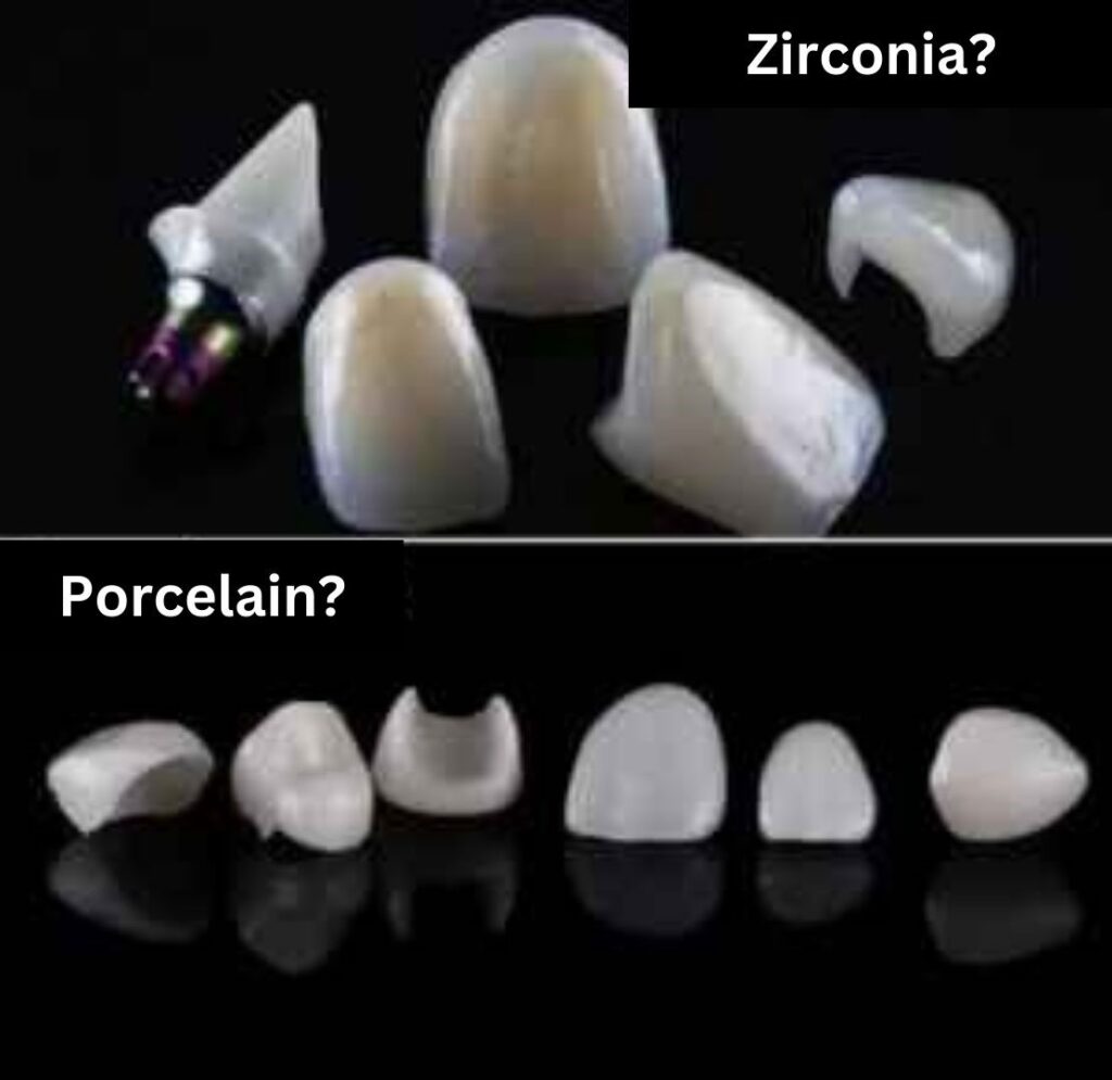 Which is better porcelain or zirconia dental crown veneer? Turkey
