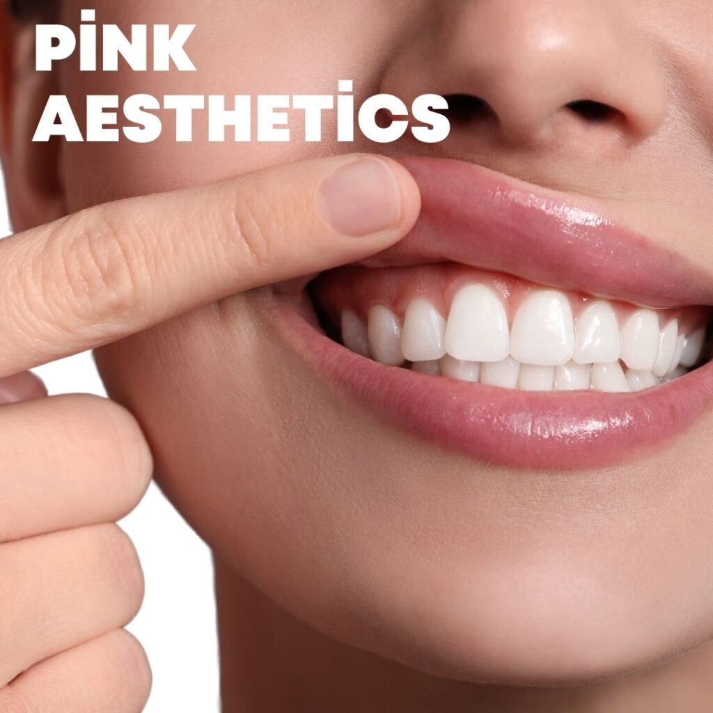 Pink Aesthetics | Gum Aesthetics | Avedent Turkey Dental Clinic