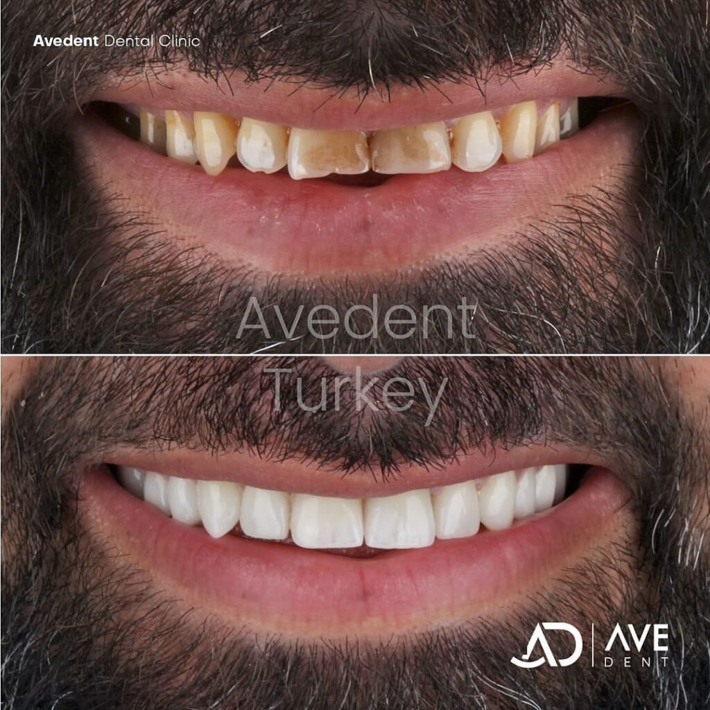 dental-before-and-after-3