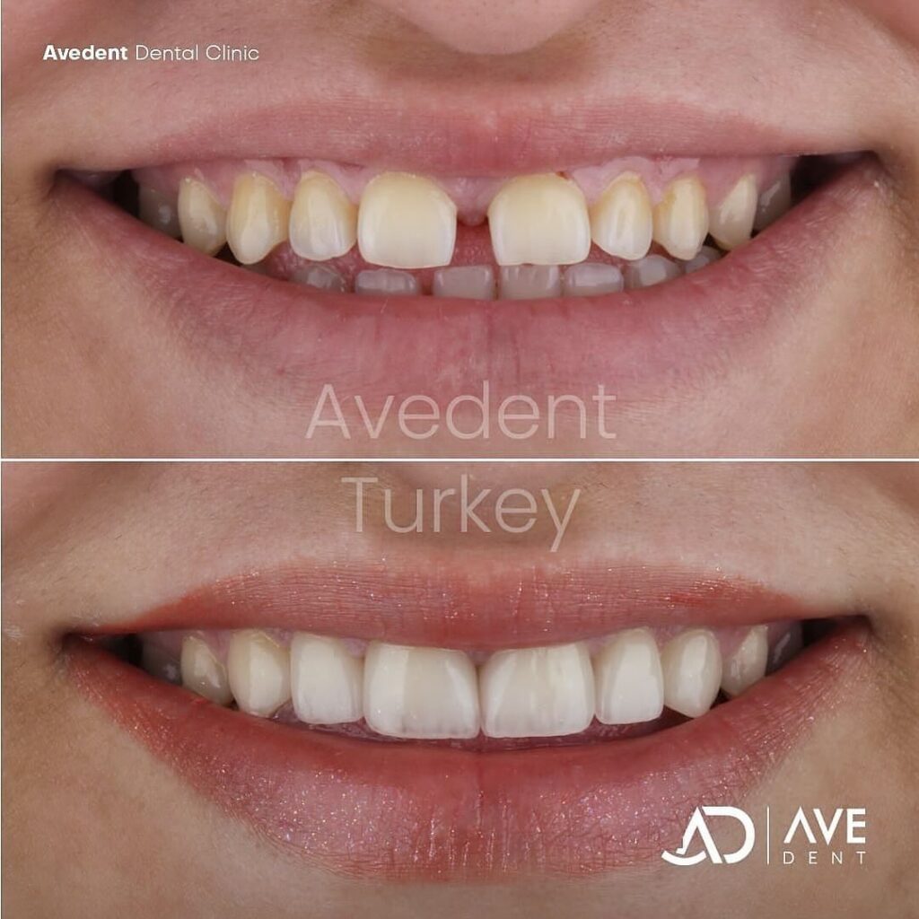 dental-before-and-after-4