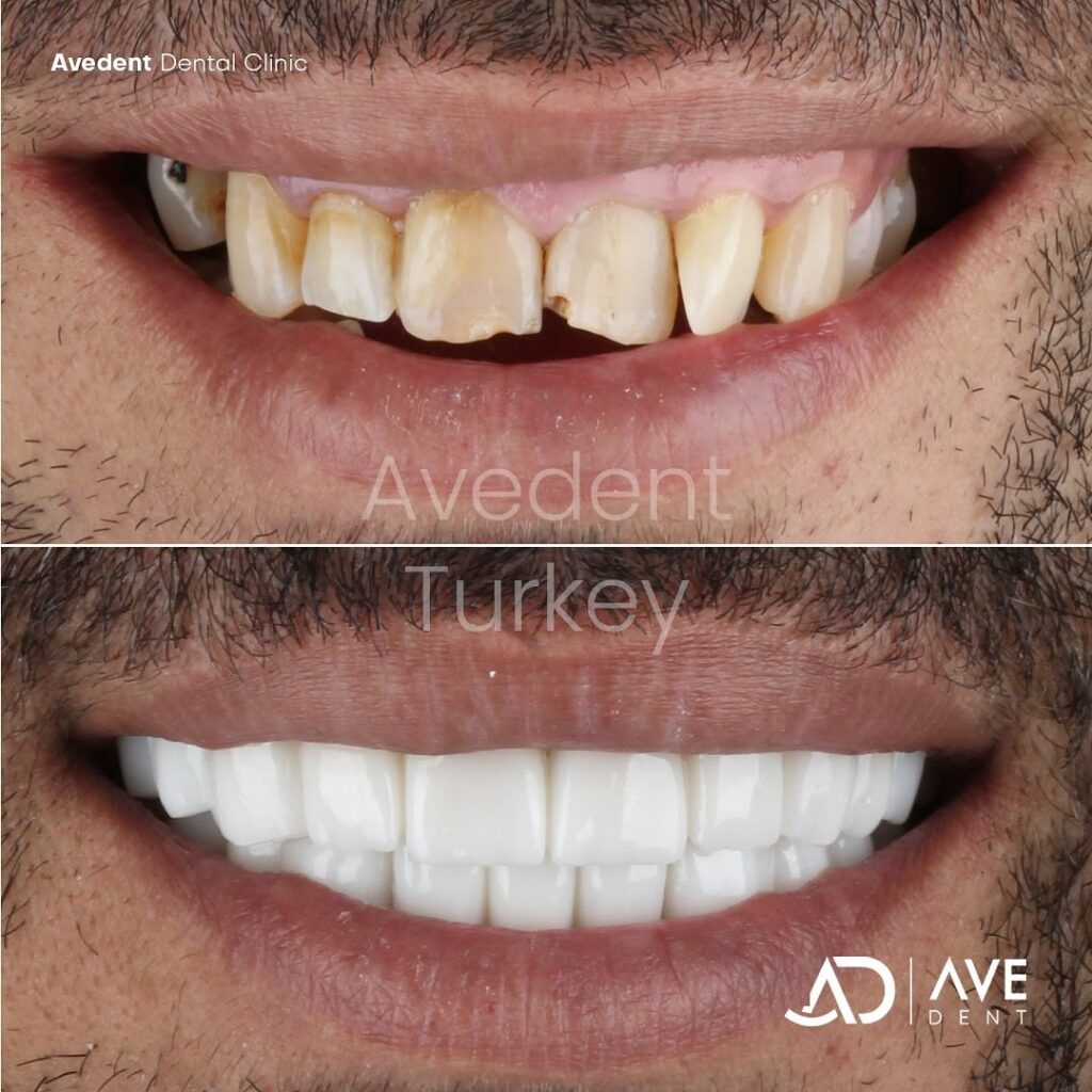 dental-before-and-after-6