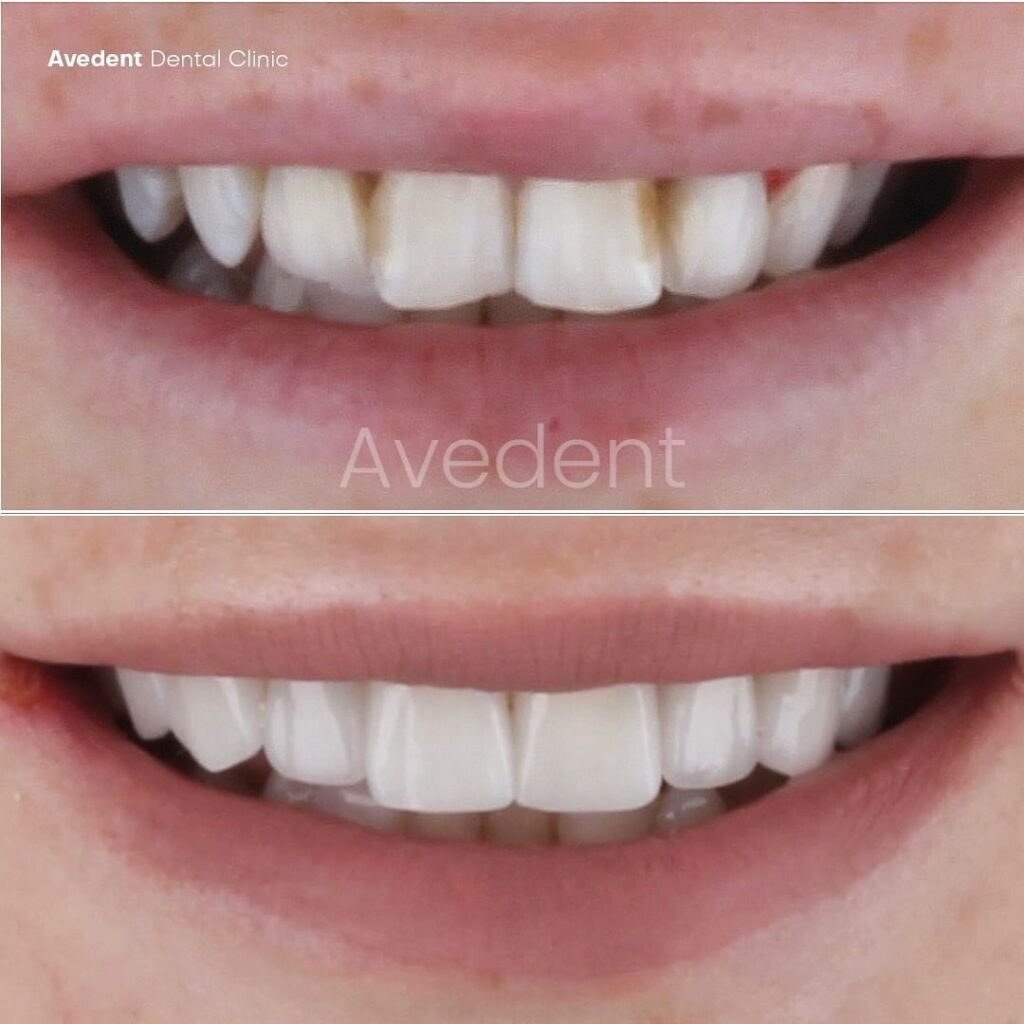 dental-before-and-after-8