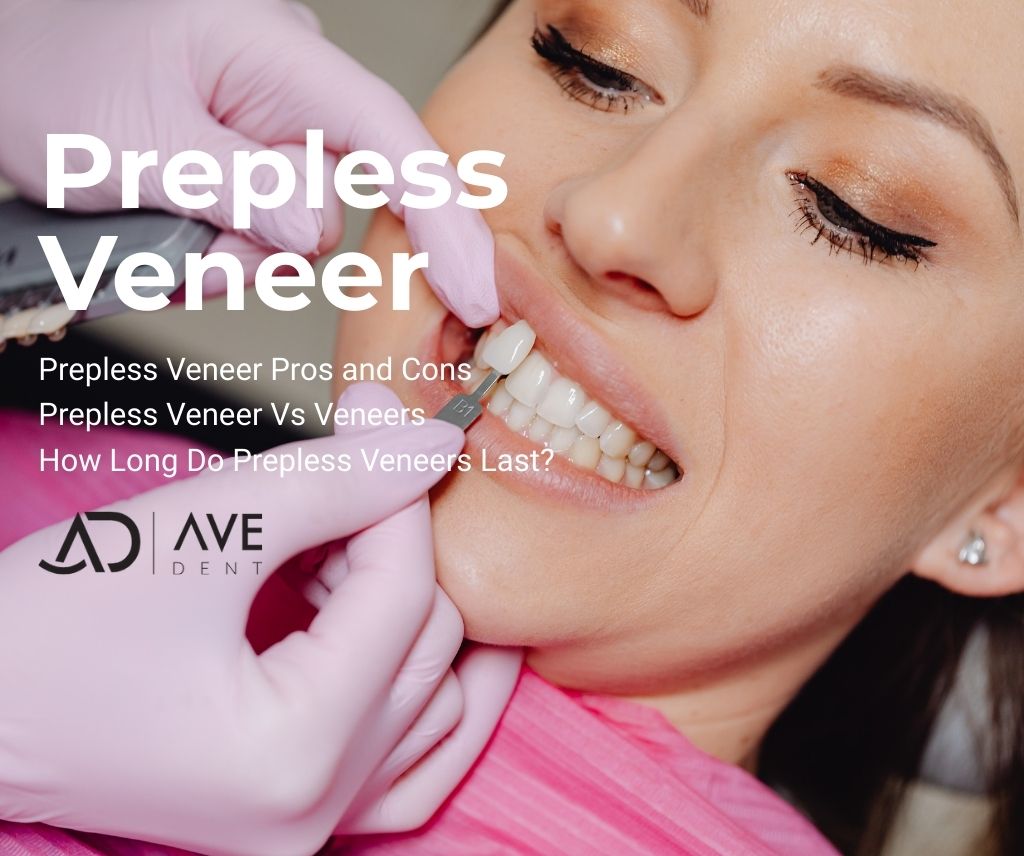 Prepless veneer in Turkey, Istanbul