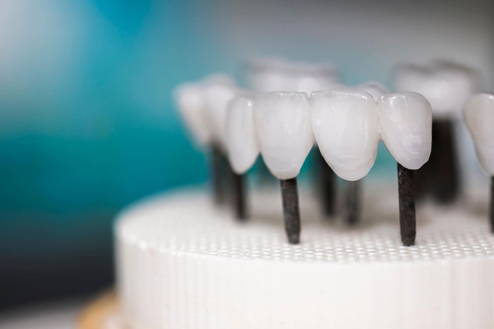 Zirkonyum Diş Kaplama Uygulaması Nasıl Yapılır?