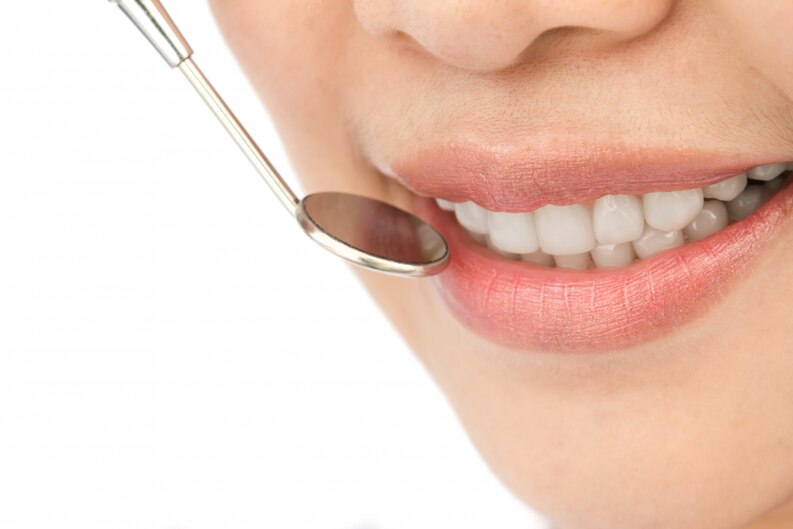 Diş Dolgusu Nedir? Beyaz Dolgu Nedir? Diş Dolgusu Çeşitleri Nelerdir?