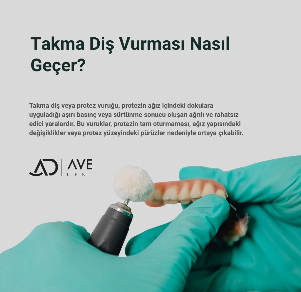 Takma Diş Vurması Nasıl Geçer? Protez Diş Vurursa Ne Yapılmalı?