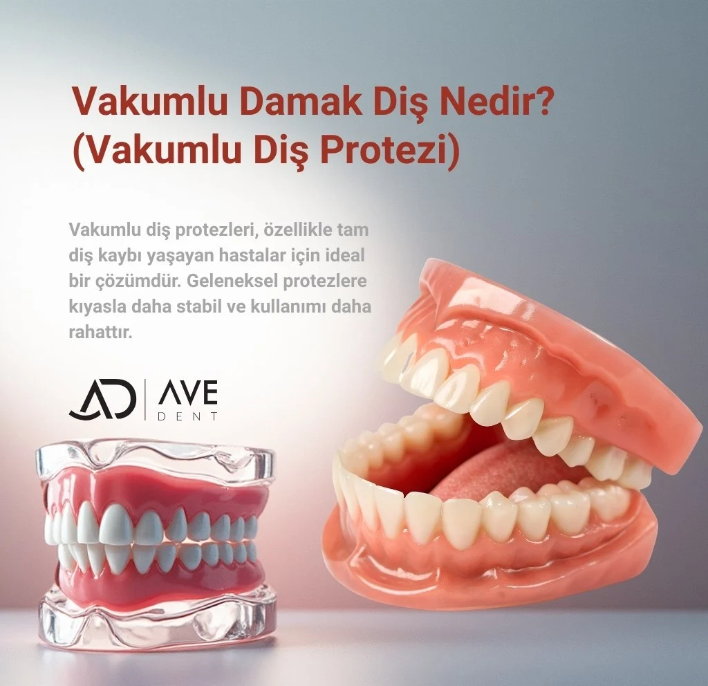 Vakumlu Damak Diş Nedir? Vakumlu Diş Protezi Fiyatları İstanbul Kartal